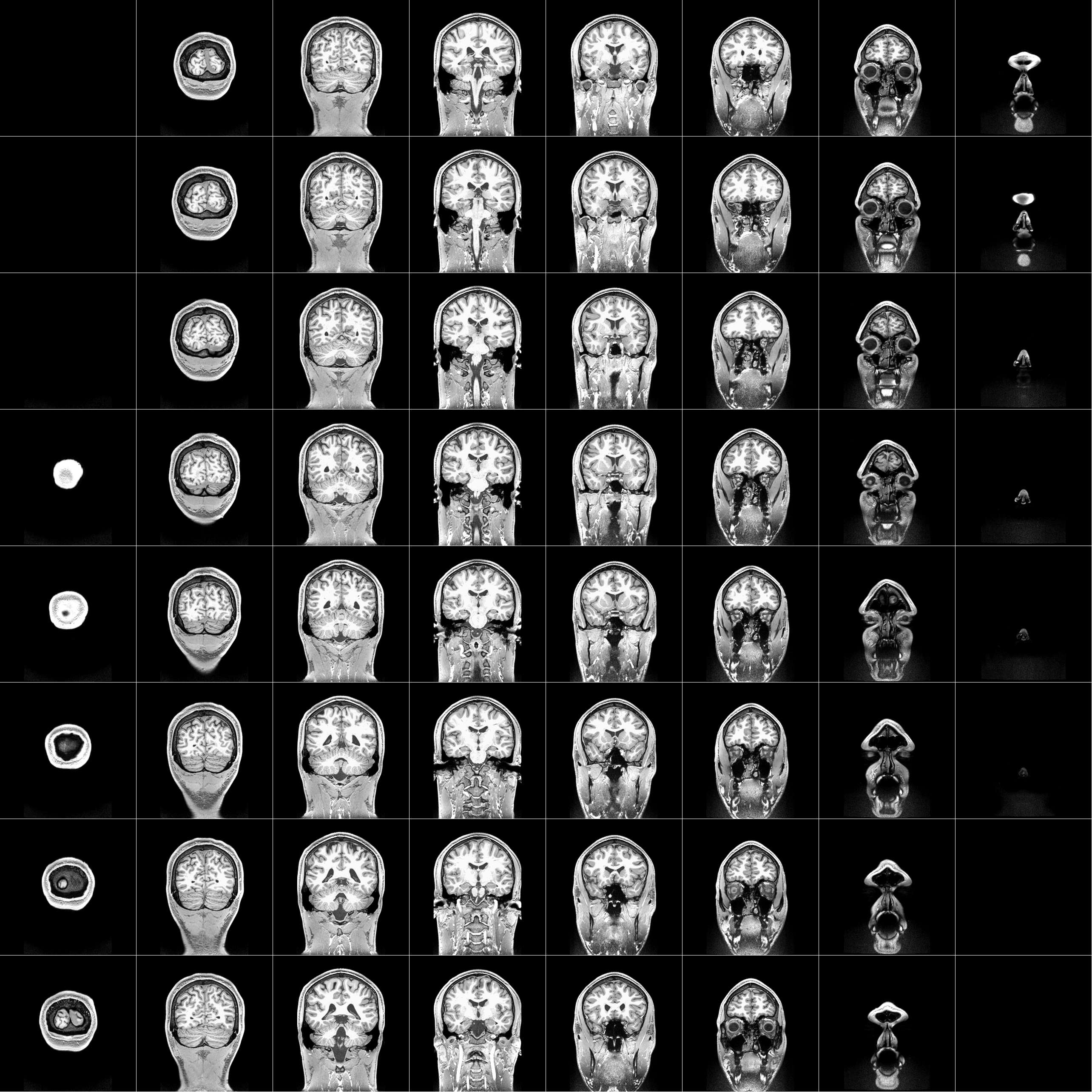 fMRI Scan View 1