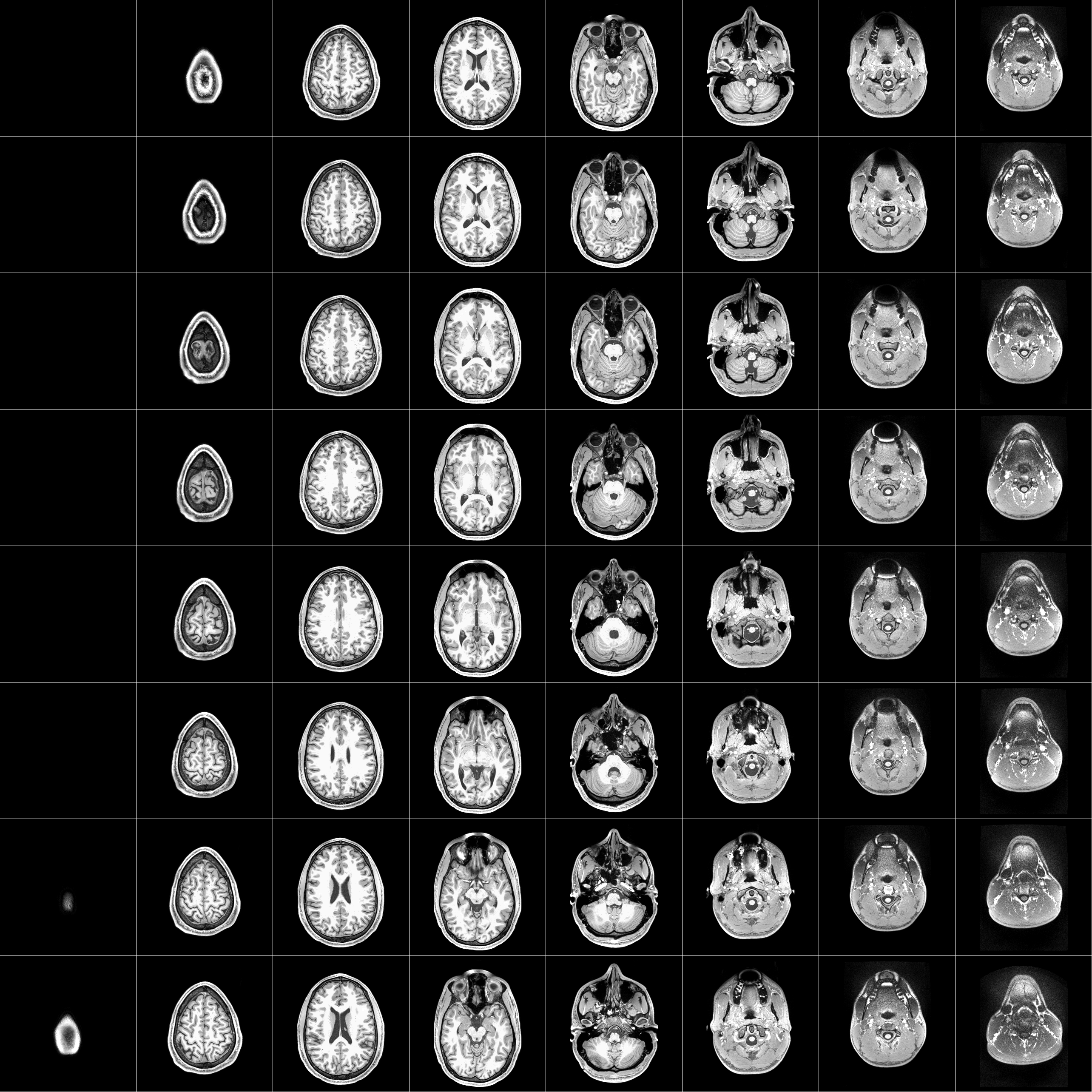 fMRI Scan View 2