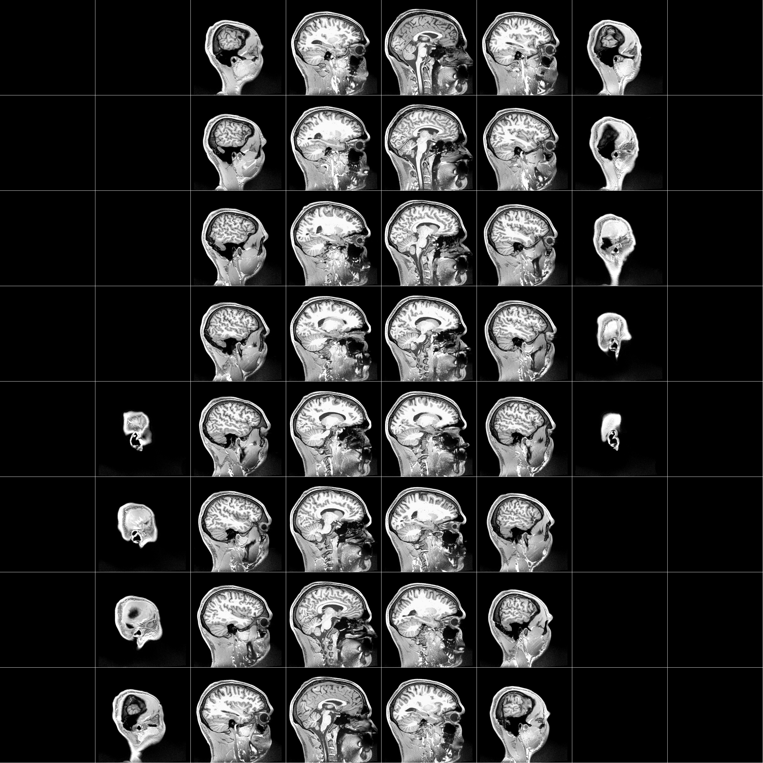 fMRI Scan View 3
